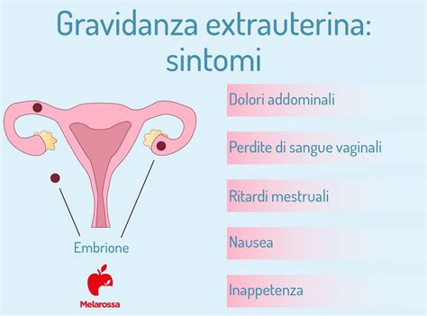 Cos'è una gravidanza extrauterina?